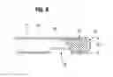 Fig. 05 - Modified veress needle for tension pneumothorax decompression