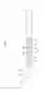 Fig. 02 - PUNCTURE NEEDLE