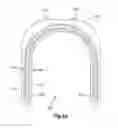 Fig. 09 - External bone fixation device