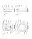 Fig. 28 - External bone fixation device
