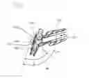 Fig. 24 - Set of instruments for the percutaneous stabilization of the spine with the aid of pedicle screws and rods