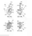 Fig. 19 - System and method for replacement of spinal motion segment