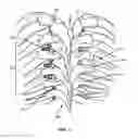 Fig. 02 - SYSTEM AND METHOD FOR CORRECTION OF A SPINAL DISORDER
