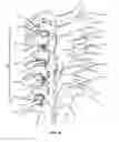 Fig. 08 - SYSTEM AND METHOD FOR CORRECTION OF A SPINAL DISORDER