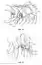 Fig. 10 - SYSTEM AND METHOD FOR CORRECTION OF A SPINAL DISORDER