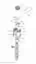 Fig. 01 - Bone anchoring device