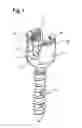 Fig. 02 - Bone anchoring device