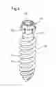 Fig. 07 - Bone anchoring device