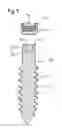 Fig. 10 - Bone anchoring device