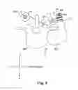 Fig. 03 - Growth modulation system