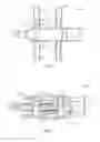 Fig. 05 - Spinous process fusion devices