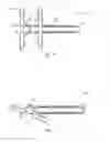 Fig. 06 - Spinous process fusion devices