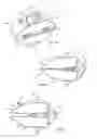 Fig. 09 - Spinous process fusion devices