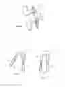 Fig. 13 - Spinous process fusion devices