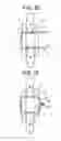 Fig. 04 - Spinous process spacer hammock