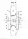 Fig. 06 - Spinous process spacer hammock