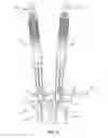 Fig. 09 - SPINAL ROD SYSTEM AND METHOD