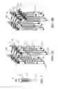 Fig. 08 - Systems, assemblies and methods for spinal derotation