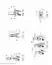 Fig. 07 - Systems, assemblies and methods for spinal derotation