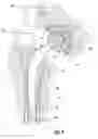 Fig. 04 - Medical implant