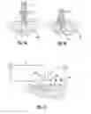 Fig. 06 - Medical implant