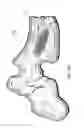 Fig. 19 - Systems and methods for treating conditions and diseases of the spine