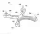 Fig. 01 - COMPRESSION CLIP FOR FRACTURED BONE