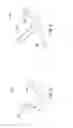 Fig. 03 - COMPRESSION CLIP FOR FRACTURED BONE