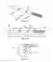 Fig. 02 - Medial column (MECO) fixation device, method, and system