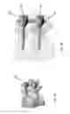 Fig. 02 - Pedicle screw assembly