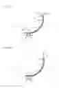 Fig. 08 - Spacer, implant assembly including the same, manufacturing method of spacer, and surgical method for spacer indwelling