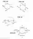 Fig. 07 - METHOD FOR TREATING FECAL INCONTINENCE
