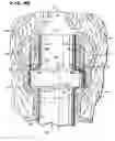 Fig. 11 - METHOD FOR TREATING FECAL INCONTINENCE