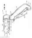 Fig. 17 - METHOD FOR TREATING FECAL INCONTINENCE