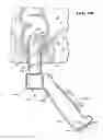 Fig. 25 - METHOD FOR TREATING FECAL INCONTINENCE