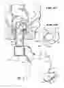 Fig. 26 - METHOD FOR TREATING FECAL INCONTINENCE