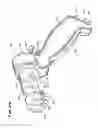 Fig. 27 - METHOD FOR TREATING FECAL INCONTINENCE
