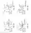Fig. 04 - Generation of a mating surface model for patient specific cutting guide based on anatomical model segmentation