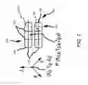 Fig. 08 - Generation of a mating surface model for patient specific cutting guide based on anatomical model segmentation