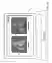 Fig. 14 - Generation of a mating surface model for patient specific cutting guide based on anatomical model segmentation
