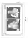 Fig. 17 - Generation of a mating surface model for patient specific cutting guide based on anatomical model segmentation