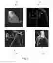 Fig. 03 - Method and system for automated therapy planning for arterial stenosis