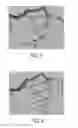 Fig. 05 - Method and system for automated therapy planning for arterial stenosis