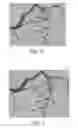 Fig. 06 - Method and system for automated therapy planning for arterial stenosis