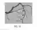 Fig. 08 - Method and system for automated therapy planning for arterial stenosis