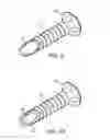 Fig. 03 - Illuminated and modular soft tissue retractor