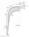 Fig. 17 - Illuminated and modular soft tissue retractor