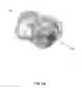 Fig. 03 - System and method for cardiac ablation