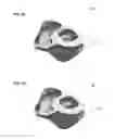 Fig. 11 - System and method for cardiac ablation