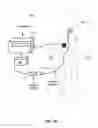 Fig. 14 - System and method for cardiac ablation